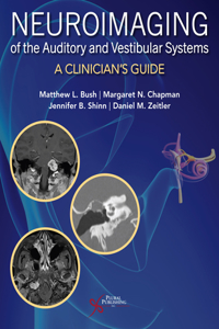 Neuroimaging of the Auditory and Vestibular Systems