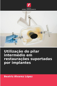 Utilização do pilar intermédio em restaurações suportadas por implantes