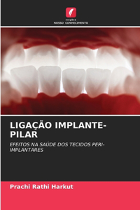 Ligação Implante-Pilar