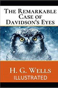 The Remarkable Case of Davidson's Eyes Illustrated