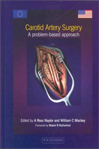 Carotid Artery Surgery