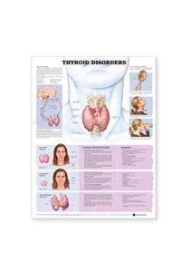 Thyroid Disorders Anatomical Chart