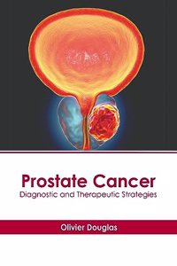 Prostate Cancer: Diagnostic and Therapeutic Strategies