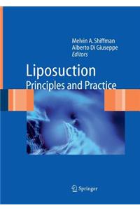 Liposuction