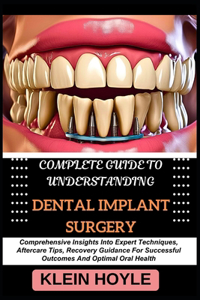 Complete Guide to Understanding Dental Implant Surgery