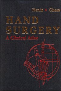Hand Surgery
