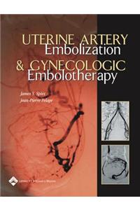 Uterine Artery Embolization and Gynecologic Embolotherapy