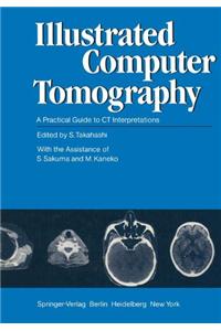 Illustrated Computer Tomography