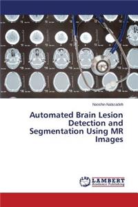 Automated Brain Lesion Detection and Segmentation Using MR Images