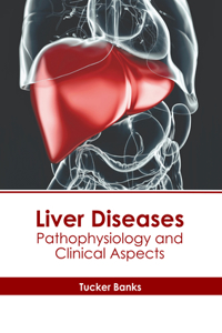 Liver Diseases: Pathophysiology and Clinical Aspects