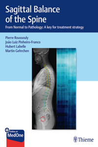 Sagittal Balance of the Spine