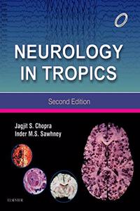 Neurology in Tropics