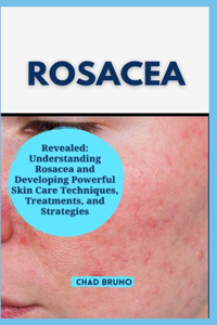 Rosacea