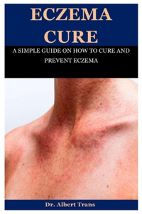 Eczema Cure