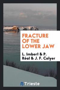 Fracture of the Lower Jaw