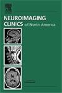 Ophthalmologic Imaging, An Issue of Neuroimaging Clinics (The Clinics: Radiology)