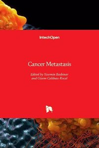 Cancer Metastasis