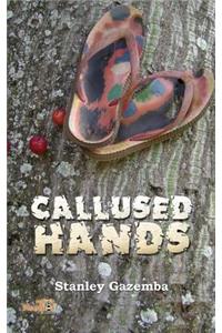 Callused Hands