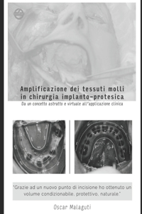 Amplificazione Dei Tessuti Molli in Chirurgia Implanto-Protesica