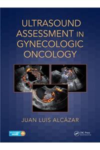 Ultrasound Assessment in Gynecologic Oncology