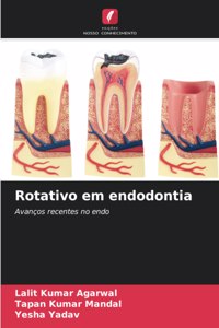 Rotativo em endodontia