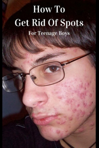 How To Get Rid Of Spots