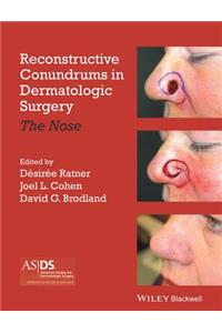 Reconstructive Conundrums in Dermatologic Surgery