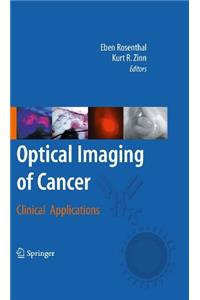 Optical Imaging of Cancer