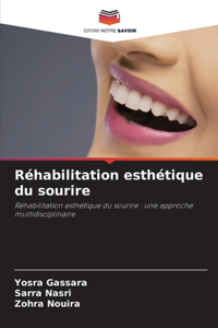 Réhabilitation esthétique du sourire