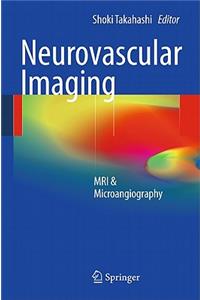 Neurovascular Imaging