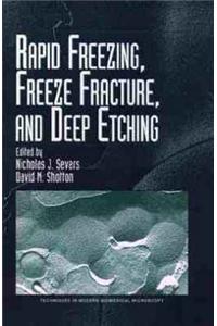 Rapid Freezing, Freeze Fracture and Deep Etching