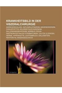 Krankheitsbild in Der Viszeralchirurgie