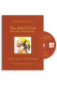 The MACS-Lift