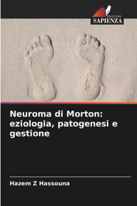 Neuroma di Morton