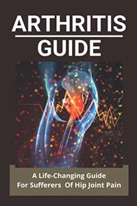 Arthritis Guide