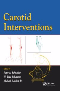 Carotid Interventions