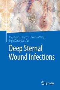 Deep Sternal Wound Infections