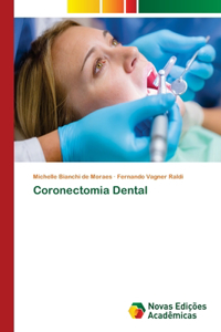 Coronectomia Dental