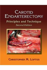 Carotid Endarterectomy