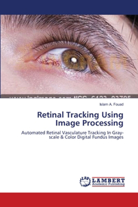 Retinal Tracking Using Image Processing