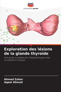 Exploration des lésions de la glande thyroïde
