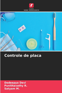 Controle de placa