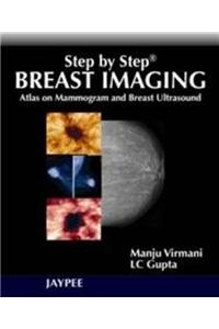 Step by Step Breast Imaging