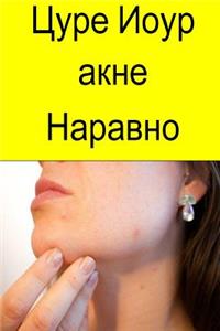 Cure Your Acne Naturally (Serbian)