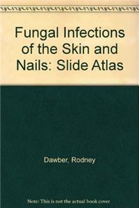 Fungal Infections of the Skin and Nail: Slide Atlas
