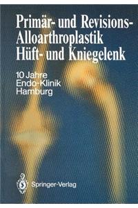 Primär- Und Revisions-Alloarthroplastik Hüft- Und Kniegelenk