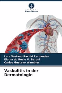 Vaskulitis in der Dermatologie