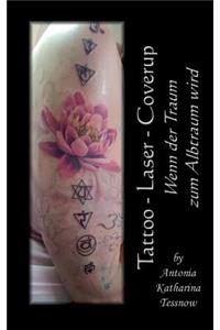 Tattoo - Laser - Cover Up