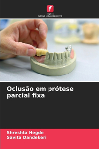 Oclusão em prótese parcial fixa