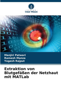 Extraktion von Blutgefäßen der Netzhaut mit MATLab